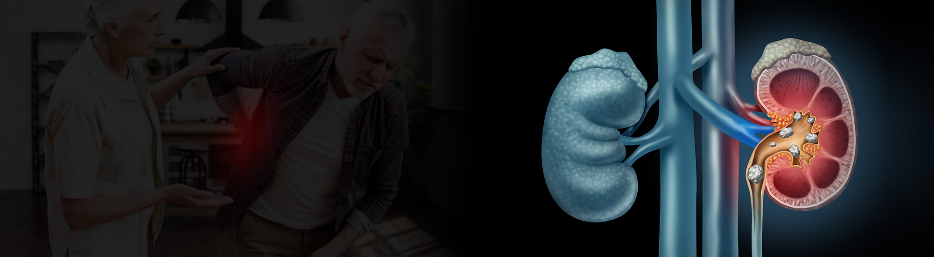 ಮೂತ್ರಪಿಂಡದಲ್ಲಿ ಕಲ್ಲಿದ್ದಲ್ಲಿ ಪರಿಹಾರವೇನು ? ಉಂಟಾಗಲು ಕಾರಣ ಮತ್ತು ಅದರ ವಿಧಗಳು